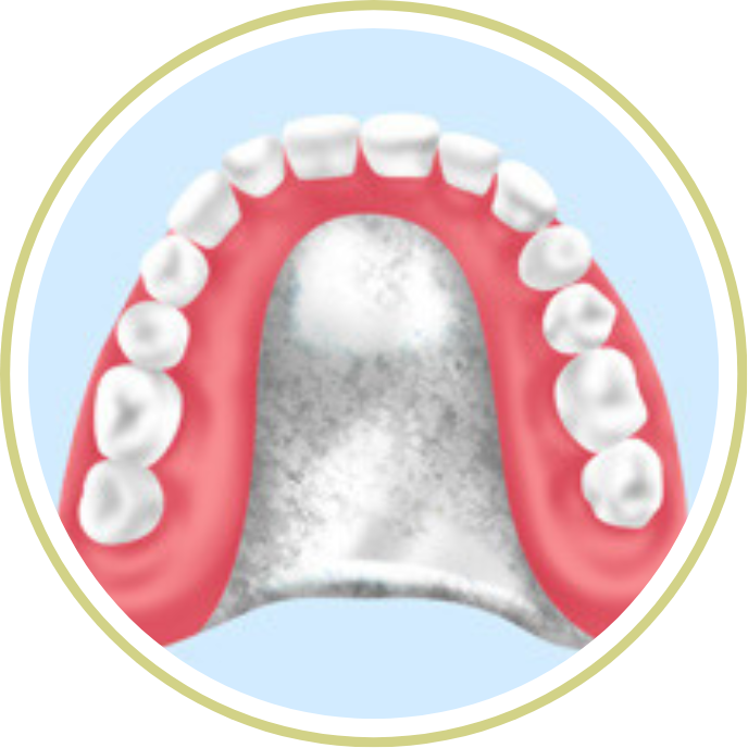チタン床義歯